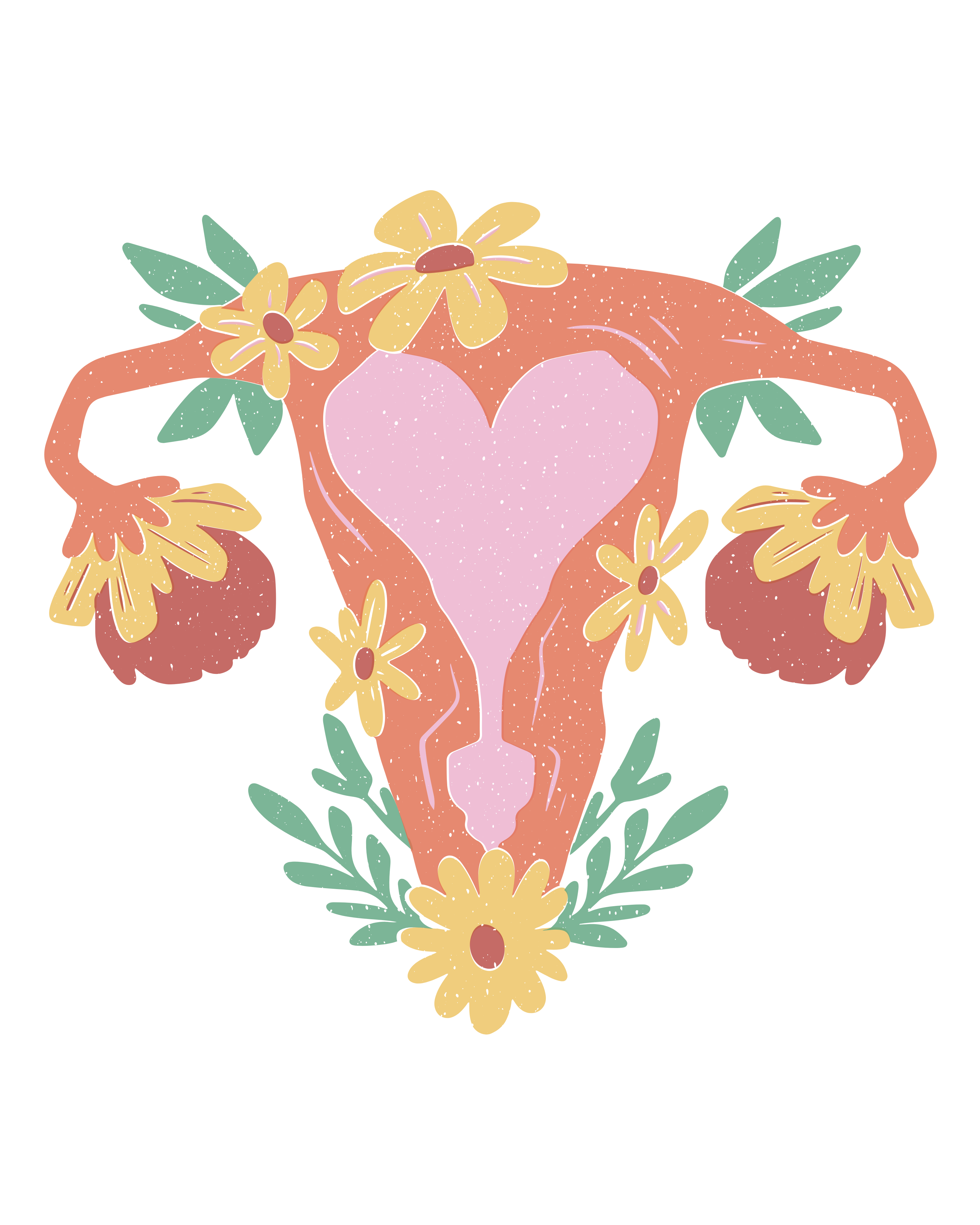 Diagram illustrating an anovulatory cycle showing absence of BBT rise and progesterone production